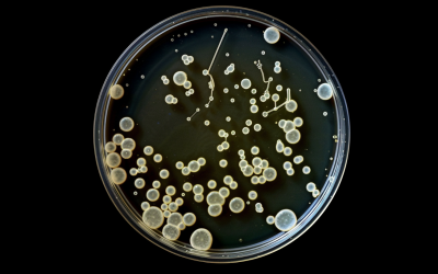 The Importance of Annual Water Testing: Understanding Total Coliform